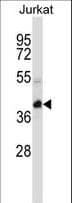 KCTD10 Antibody (aa273-301)