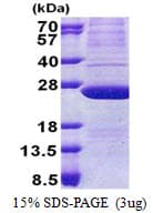 Human ATP5H Protein (Recombinant His)
