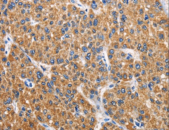 APLNR/ Apelin Receptor / APJ Antibody