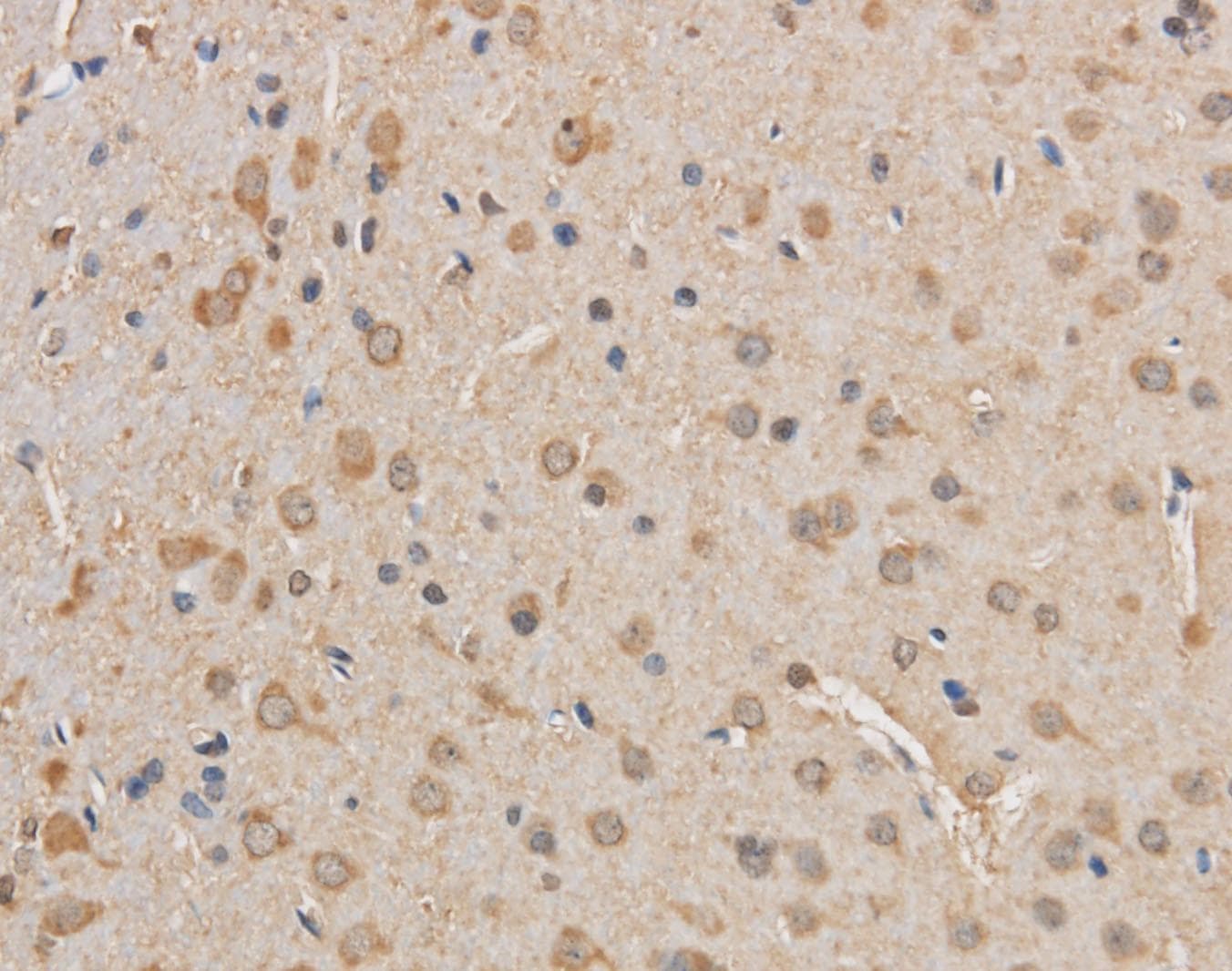 VDAC1 / PORIN Antibody