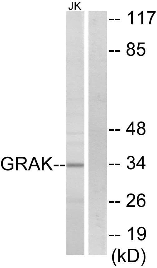GZMK / Granzyme K Antibody (aa61-110)