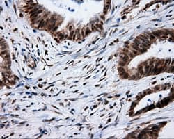 SRR / Serine Racemase Antibody (clone OTI7E8, Carrier-free)