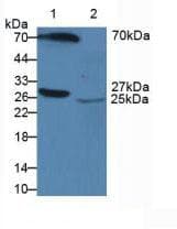 APCS / Serum Amyloid P / SAP Antibody (aa23-223)