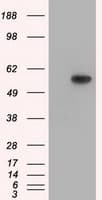 TS / Thromboxane Synthase Antibody (clone OTI2C1)