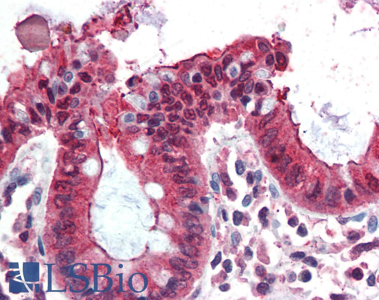 IHC-plus™ EZR / Ezrin Antibody (aa352-363)