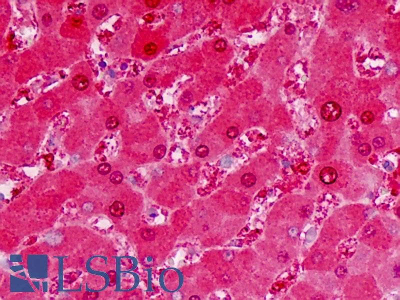 IHC-plus™ ALDH5A1 Antibody (aa128-157)