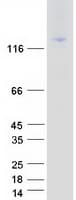 Human ITGAL / CD11a Protein (Recombinant Myc-DDK (Flag))