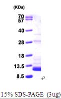 Mouse S100B / S100 Beta Protein (Recombinant His)