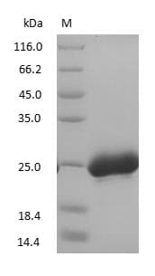 NGAL/MMP9 Complex Protein (Native)