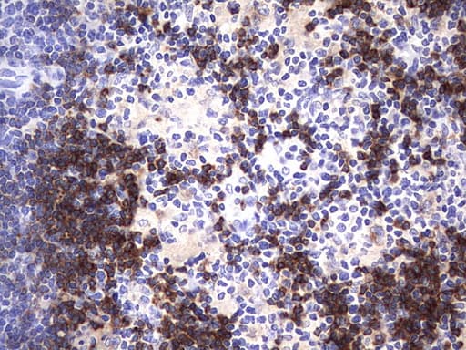 Monoclonal Mouse anti-Human CD79A / CD79 Alpha Antibody (clone OTI3D3, IHC, WB)