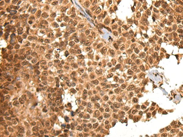 KIAA1811 / BRSK1 Antibody