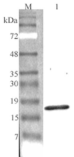 IHC-plus™ C1QTNF7 / CTRP7 Antibody (Globular domain)