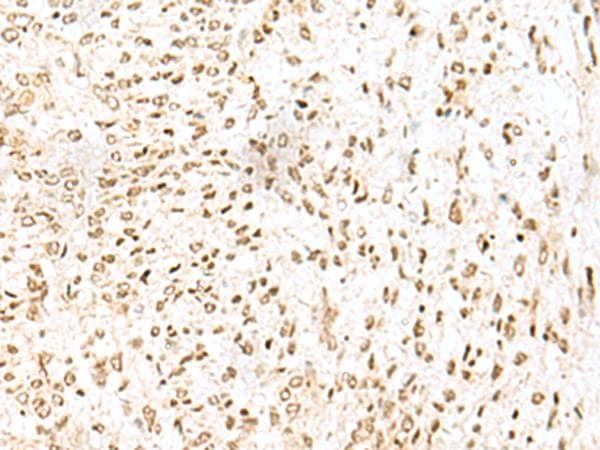 LYRM1 Antibody