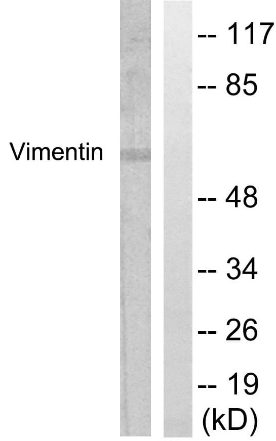 Vimentin Antibody (aa31-80)