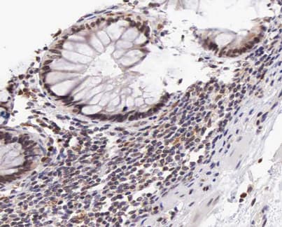Polyclonal Rabbit anti-Human LGALS3 / Galectin 3 Antibody (IHC, IF, WB)