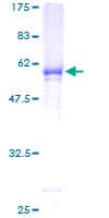 Human GALNT12 Protein (Recombinant GST)