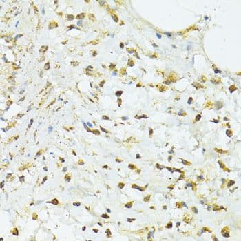 Polyclonal Rabbit anti-Human TRIM15 Antibody (IHC, WB)