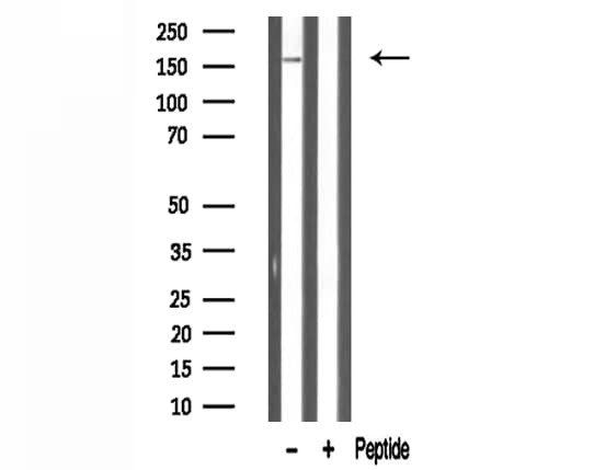 DGK-IOTA / DGKI Antibody