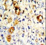 MMP19 Antibody (aa344-373)