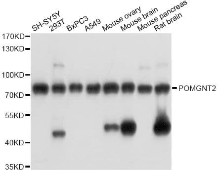 POMGNT2 / GTDC2 Antibody