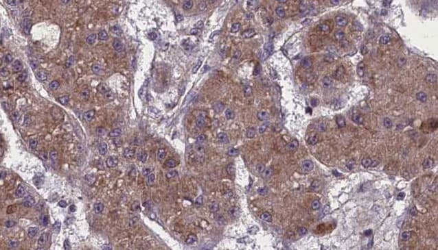 OR52K2 Antibody