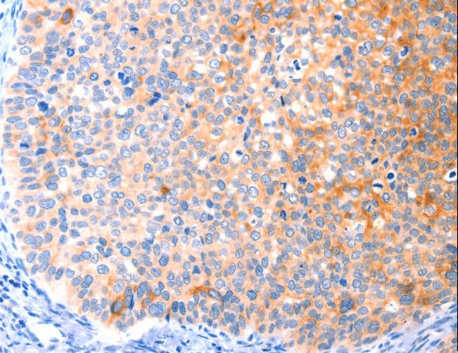 CCDC88A / GIV / Girdin Antibody