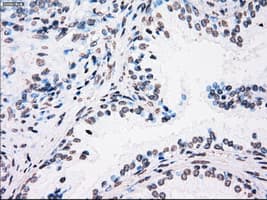 PLK1 / PLK-1 Antibody (clone OTI1A2)