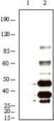Monoclonal Mouse anti-Virus HHV-8 K8 alpha Antibody (clone 8C12G10G1, IHC, WB)