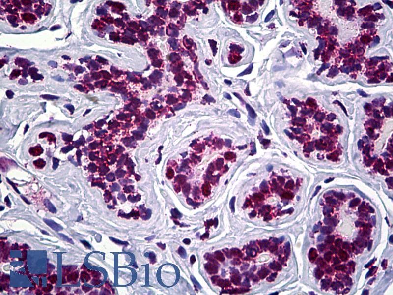 IHC-plus™ Monoclonal Mouse anti-Human STAG2 Antibody (clone 3C6, IHC, IF, WB)