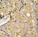 TRPM8 Antibody (aa521-552)