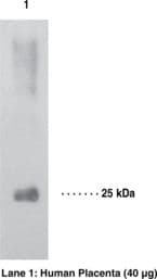 IHC-plus™ Polyclonal Rabbit anti-Human 15-PGDH / HPGD Antibody (IHC, WB)