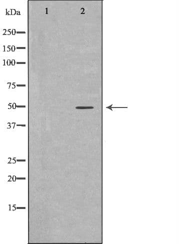 WT1 / Wilms Tumor 1 Antibody