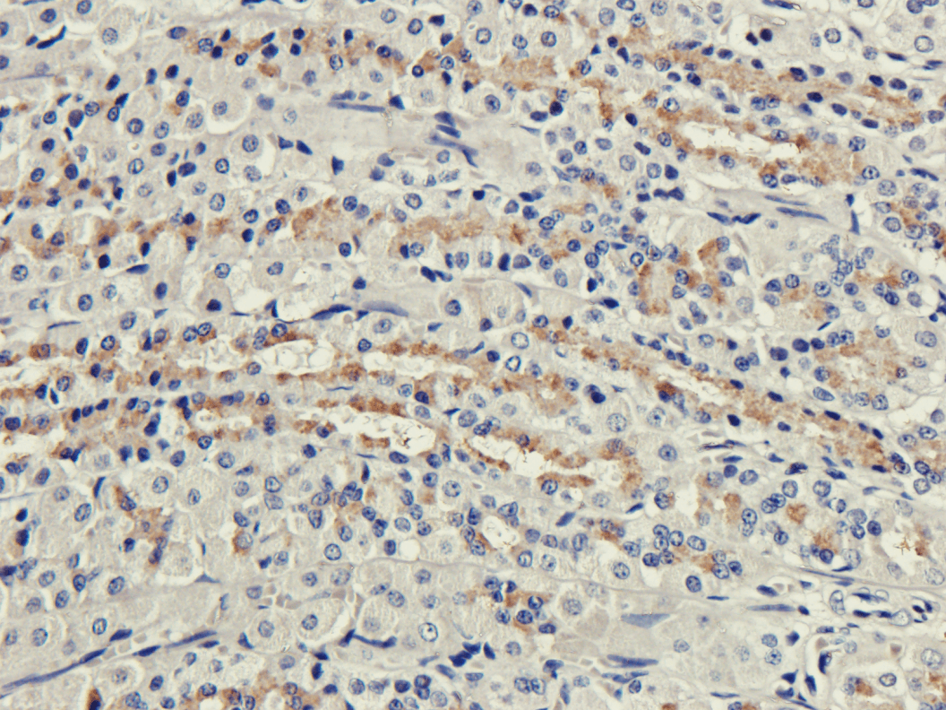 Recombinant Monoclonal Rabbit anti-Mouse CR1 / CD35 Antibody (clone 8C12, CD35 (complement receptor 1), IHC, WB)