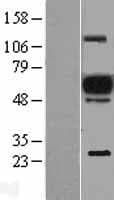EVI2A Protein (Over-Expression Lysate Myc-DDK (Flag))