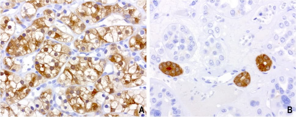 BBOX1 / BBOX Antibody (clone UMAB120)