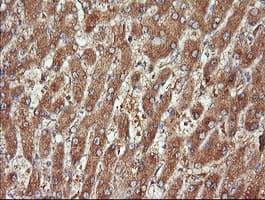 CTAG1B / NY-ESO-1 Antibody (clone OTI5E1)