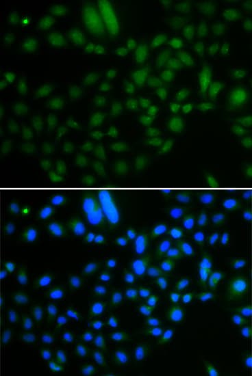 Polyclonal Rabbit anti-Human ALKBH8 Antibody (IHC, IF, WB)