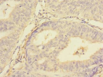 PMPCA Antibody