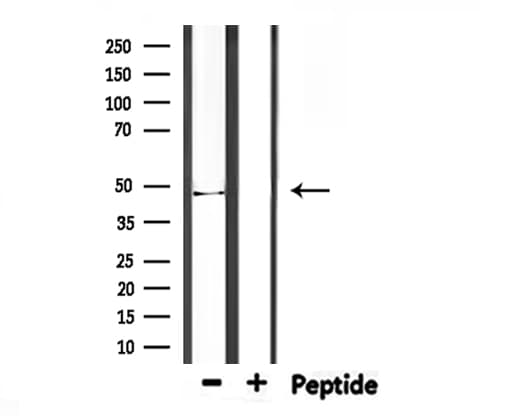 Polyclonal Rabbit anti-Human IDH1 / IDH Antibody (IHC, WB)