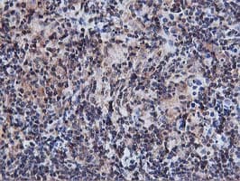 AKT1 Antibody (clone OTI4E10)