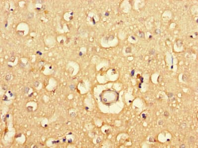 FRA9F Antibody