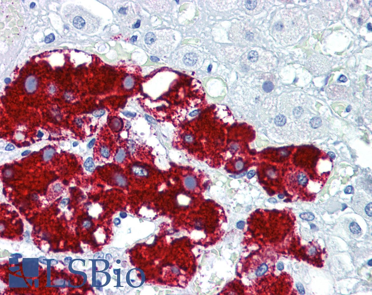 PathPlus™ PDPN / Podoplanin Antibody (C-Terminus)
