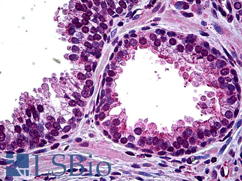 IHC-plus™ HIPK2 Antibody (clone 1F10)