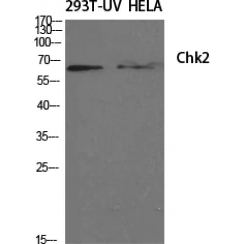 CHEK2 / CHK2 Antibody (10-90 aa)