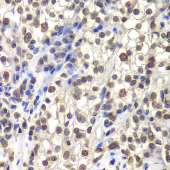 CENPC / CENP-C Antibody