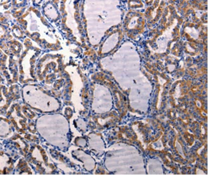 DRD1 / Dopamine Receptor D1 Antibody (aa338-446)