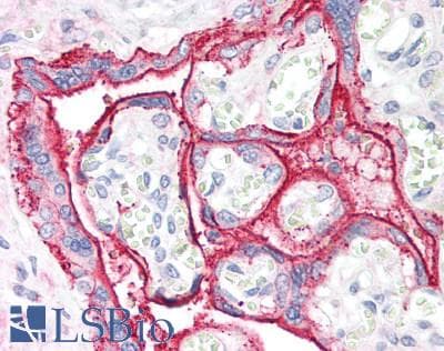 CCK / Cholecystokinin Antibody (aa1-115)