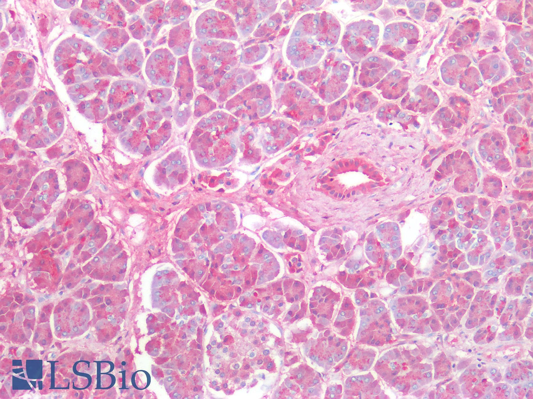 PathPlus™ PRSS1 / Trypsin Antibody