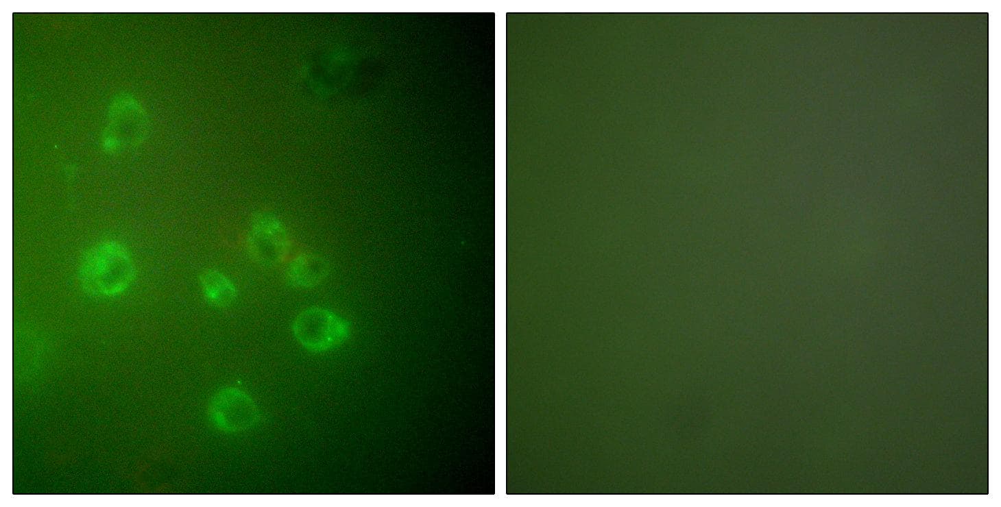 HSPA5 / GRP78 / BiP Antibody