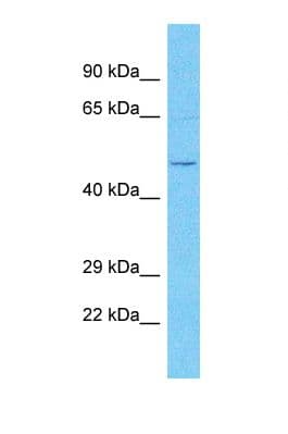 OVCH2 Antibody (aa490-539)